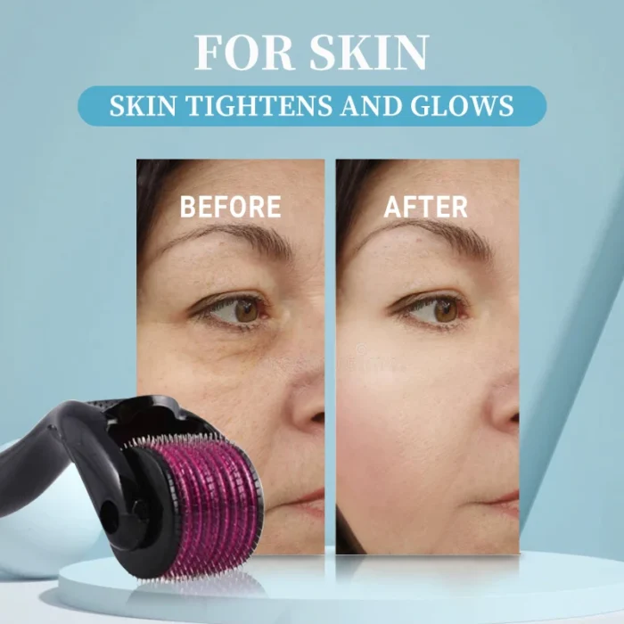 Micro Needling 540 Derma Roller - Image 4